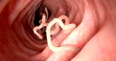 Causas de parásitos en el cuerpo humano