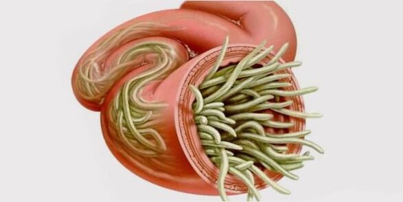 gusanos en el cuerpo humano
