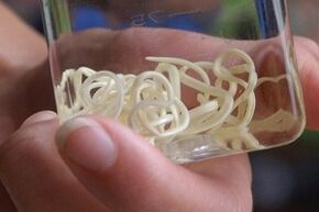 Parásitos del cuerpo humano.