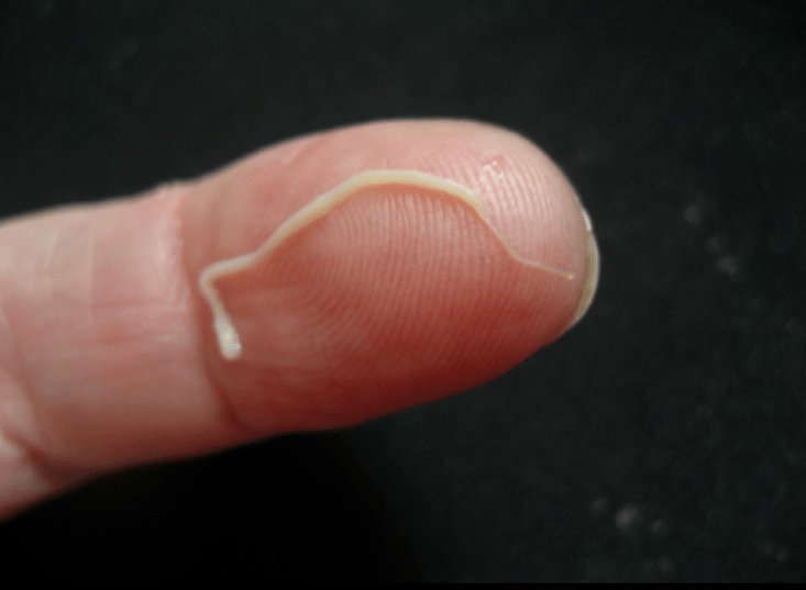 Parásitos de lombrices intestinales de humanos